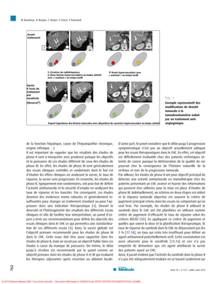 M Bouattour, H Marijon, C Dreyer, S Faivre, É Raymond




                                                                                                                                             Fig. 1
                                                                                                                                             Exemple représentatif des
                                                                                                                                             modifications de densité
                                                                                                                                             tumorale à la
                                                                                                                                             tomodensitométrie induit
                                                                                                                                             par un traitement anti-
                                                                                                                                             angiogénique




                     de la fonction hépatique, cause de l’hépatopathie chronique,                       D’autre part, le panel considère que le délai jusqu’à progression
                     origine ethnique. . .).                                                            symptomatique n’est pas un objectif actuellement adéquat
                     Il est important de rappeler que les résultats des études de                       pour les essais thérapeutiques dans le CHC. En effet, cet objectif
                     phase II sont à interpréter avec prudence puisque les objectifs                    est difficilement évaluable chez des patients cirrhotiques at-
                     et la puissance de ces études diffèrent de ceux des études de                      teints de cancer puisque la détérioration de la qualité de vie
                     phase III. En effet, les études de phase III sont généralement                     pourrait être la conséquence de l’histoire naturelle de la
                     des essais cliniques contrôlés et randomisés dont le but est                       cirrhose et non de la progression tumorale.
                     d’étudier les effets cliniques en analysant la survie, le taux de                  Par ailleurs, les études de phase II ont pour objectif principal de
                     réponse, la survie sans progression. En revanche, les études de                    détecter une activité antitumorale en monothérapie chez les
                     phase II, typiquement non randomisées, ont pour but de définir                     patients présentant un CHC avancé et fournir des informations
                     l’activité antitumorale et la sécurité d’emploi en analysant les                   qui peuvent être utilisées pour la mise en place d’études de
                     taux de réponse et les toxicités. Par conséquent, ces études                       phase III. Habituellement, un schéma en deux étapes est utilisé
                     donnent des évidences moins robustes et généralement in-                           et la réponse tumorale objective est souvent le critère de
                     suffisantes pour changer un traitement standard ou pour l’ap-                      jugement principal retenu dans les essais ne comportant qu’un
                     prouver dans une indication thérapeutique [4]. Devant la                           seul bras. Par exemple, les études de phase II utilisant le
                     diversité et l’hétérogénéité des résultats des différents essais                   sunitinib dans le CHC ont été planifiées en utilisant comme
                     cliniques et afin de faciliter leur interprétation, un panel d’ex-                 critère de jugement d’efficacité le taux de réponse selon les
                     pert a émis ses recommandations pour définir les objectifs des                     critères RECIST [50]. En appliquant ce critère de jugement et
                     essais cliniques dans le CHC ce qui permettra une standardisa-                     quelles que soient la dose et la planification thérapeutique, le
                     tion de ces différents essais [4]. Ainsi, la survie globale est                    taux de réponse du sunitinib dans le CHC ne dépassaient pas les
                     l’objectif primaire recommandé pour les études de phase III                        5 % [17,18], un taux qui reste très insuffisant pour définir un
                     dans le CHC. Cette issue doit être aussi rapportée dans les                        agent antitumoral potentiellement actif. Cette constatation est
                     études de phase II, mais ne serait pas un objectif fiable dans ces                 aussi observée pour le sorafénib [13,14] et ceci n’a pas
                     études à cause du manque de puissance. De même, le délai                           empêché de démontrer que cet agent améliorait la survie
                     jusqu’à récidive est recommandé par le panel comme un                              des patients ayant un CHC.
                     objectif primaire dans les études de phase II et III qui évaluent                  Ainsi, il parait évident que l’activité du sunitinib dans la phase II
                     les thérapies adjuvantes après résection ou ablation locale.                       n’a pas été adéquatement évaluée en se basant seulement sur
       762




                                                                                                                                                 tome 39  n87/8  juillet–août 2010




© 2010 Elsevier Masson SAS. Tous droits réservés. - Document téléchargé le 19/08/2010 par APHP CENTRE DOCUMENTATION (164588)
 