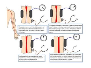 La Pression artérielle
