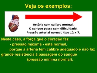 Artéria com calibre normal. O sangue passa sem dificuldade. Pressão arterial normal, tipo 12 x 7. Veja os exemplos: Neste caso, a força que o coração faz  - pressão máxima - está normal,  porque a artéria tem calibre adequado e não faz grande resistência à passagem do sangue  (pressão mínima normal).  