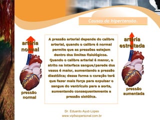 A pressão arterial depende do calibre arterial, quando o calibre é normal permite que as pressões estejam dentro dos limites fisiológicos.  Quando o calibre arterial é menor, o atrito na interface sangue/parede dos vasos é maior, aumentando a pressão diastólica; dessa forma o coração terá que fazer mais força para expulsar o sangue do ventrículo para a aorta, aumentando consequentemente a pressão sistólica. pressão  normal artéria normal pressão aumentada artéria estreitada Causas da hipertensão. 