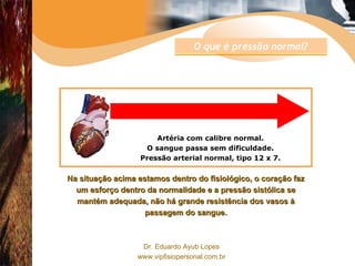Artéria com calibre normal. O sangue passa sem dificuldade. Pressão arterial normal, tipo 12 x 7. Na situação acima estamos dentro do fisiológico, o coração faz um esforço dentro da normalidade e a pressão sistólica se mantém adequada, não há grande resistência dos vasos à passagem do sangue. O que é pressão normal? 