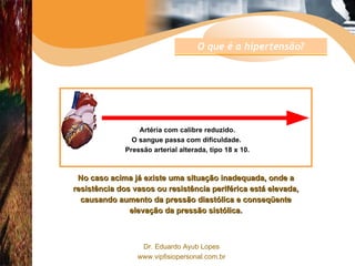 Artéria com calibre reduzido. O sangue passa com dificuldade.  Pressão arterial alterada, tipo 18 x 10. No caso acima já existe uma situação inadequada, onde a resistência dos vasos ou resistência periférica está elevada, causando aumento da pressão diastólica e conseqüente elevação da pressão sistólica. O que é a hipertensão? 