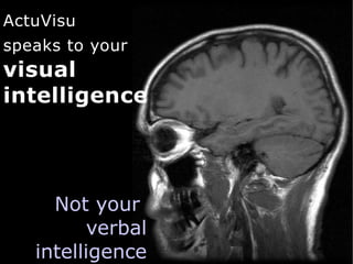 ActuVisu
speaks to your
visual
intelligence




     Not your
          verbal
   intelligence
 
