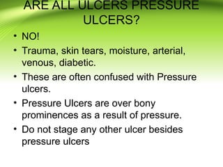 pressure ulcer prevention power point presentation | PPT