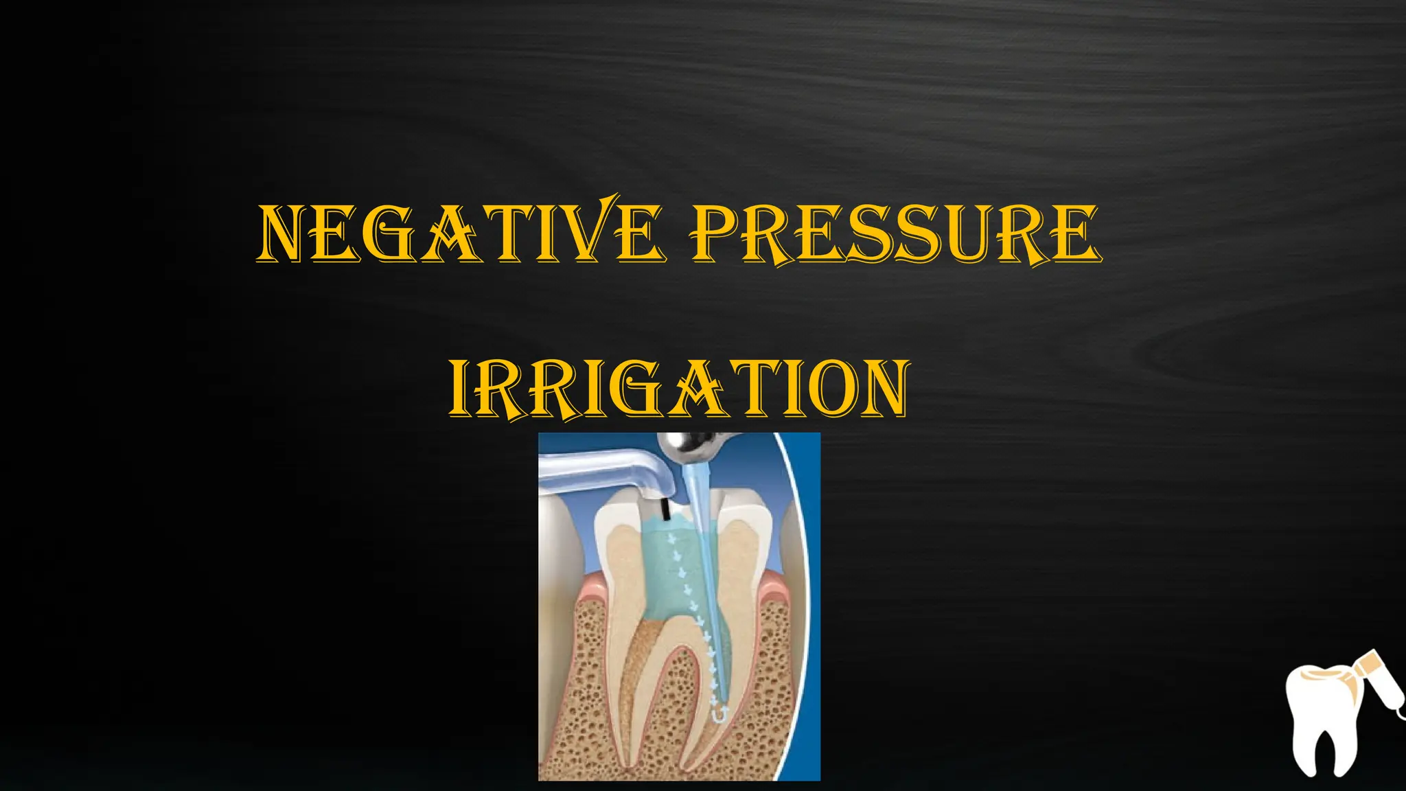 pressure irrigation in endodontics and dentistry | PPTX
