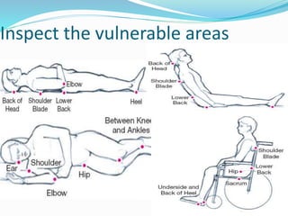 Inspect the vulnerable areas
 
