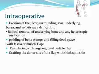 Intraoperative
 Excision of the ulcer, surrounding scar, underlying
bursa, and soft-tissue calcification,
• Radical removal of underlying bone and any heterotopic
ossification
 padding of bone stumps and filling dead space
with fascia or muscle flaps
 Resurfacing with large regional pedicle flap
 Grafting the donor site of the flap with thick split skin
 