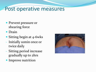 Post operative measures
 Prevent pressure or
shearing force
 Drain
 Sitting begin at 4-6wks
- Initially 10min once or
twice daily
- Sitting period increase
gradually up to 2hrs
 Improve nutrition
 