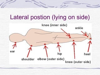 Lateral postion (lying on side)
 