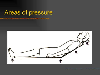 pressure-sores jdubdkojvdvdjdkoonsvagtccafsffdbdj.pdf