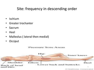 Site: frequency in descending order
• Ischium
• Greater trochanter
• Sacrum
• Heel
• Malleolus ( lateral then medial)
• Occiput
7/10/2017 3
 