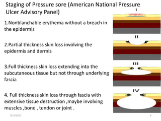 Staging of Pressure sore (American National Pressure
Ulcer Advisory Panel)
1.Nonblanchable erythema without a breach in
the epidermis
2.Partial thickness skin loss involving the
epidermis and dermis
3.Full thickness skin loss extending into the
subcutaneous tissue but not through underlying
fascia
4. Full thickness skin loss through fascia with
extensive tissue destruction ,maybe involving
muscles ,bone , tendon or joint .
7/10/2017 6
 