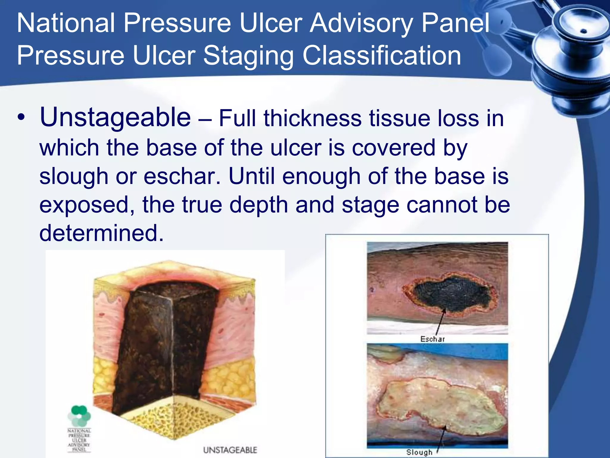 National Pressure Ulcer Advisory Panel
Pressure Ulcer Staging Classification
• Unstageable – Full thickness tissue loss in
which the base of the ulcer is covered by
slough or eschar. Until enough of the base is
exposed, the true depth and stage cannot be
determined.
 