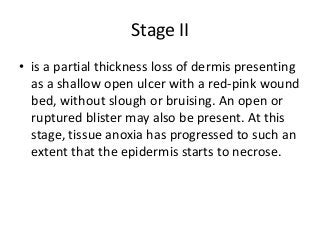 Stage II
• is a partial thickness loss of dermis presenting
as a shallow open ulcer with a red-pink wound
bed, without slough or bruising. An open or
ruptured blister may also be present. At this
stage, tissue anoxia has progressed to such an
extent that the epidermis starts to necrose.
 