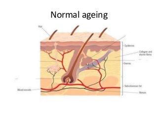Normal ageing
 