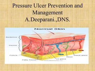 Pressure Ulcer Prevention and
Management
A.Deeparani.,DNS.
 
