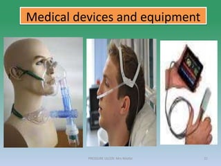 Medical devices and equipment
PRESSURE ULCER: Mrs Nilofar 21
 