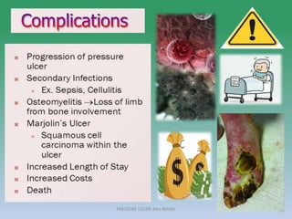 PRESSURE ULCER: Mrs Nilofar 31
 