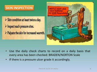 • Use the daily check charts to record on a daily basis that
every area has been checked: BRADEN/NORTON Scale
• If there is a pressure ulcer grade it accordingly.
PRESSURE ULCER: Mrs Nilofar 38
SKIN INSPECTION
 