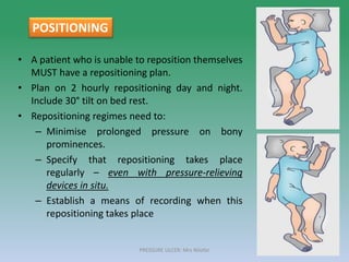 • A patient who is unable to reposition themselves
MUST have a repositioning plan.
• Plan on 2 hourly repositioning day and night.
Include 30° tilt on bed rest.
• Repositioning regimes need to:
– Minimise prolonged pressure on bony
prominences.
– Specify that repositioning takes place
regularly – even with pressure-relieving
devices in situ.
– Establish a means of recording when this
repositioning takes place
PRESSURE ULCER: Mrs Nilofar 42
POSITIONING
 