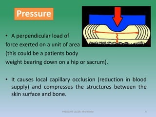 • A perpendicular load of
force exerted on a unit of area
(this could be a patients body
weight bearing down on a hip or sacrum).
• It causes local capillary occlusion (reduction in blood
supply) and compresses the structures between the
skin surface and bone.
Pressure
PRESSURE ULCER: Mrs Nilofar 6
 