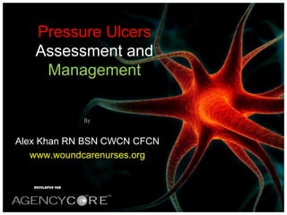 Pressure Ulcers Assessment and Management By Alex Khan RN BSN CWCN CFCN www.woundcarenurses.org DEVELOPED FOR 