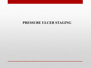 PRESSURE ULCER STAGING
 