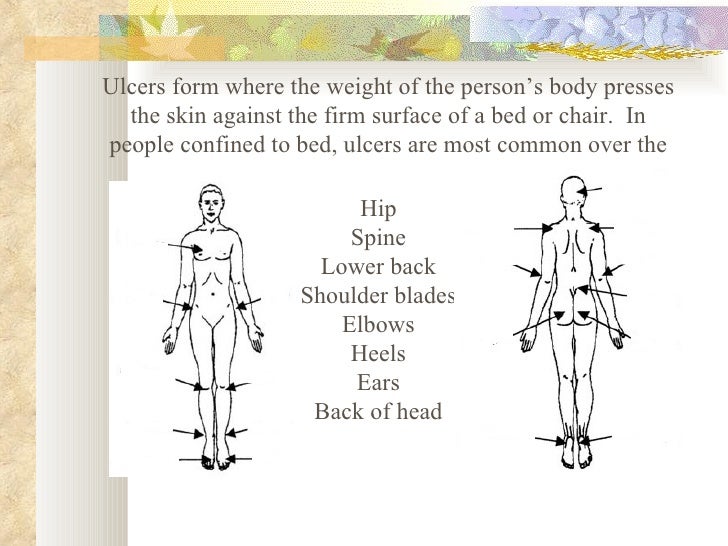 pressure ulcer prevention skin care body check form