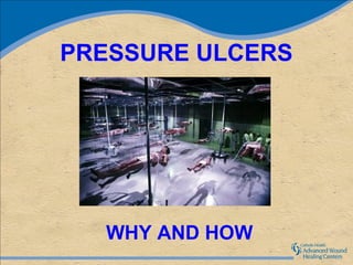 PRESSURE ULCERS




  WHY AND HOW
 