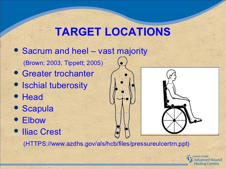 Pressure ulcers, why and how