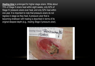 Healing time is prolonged for higher stage ulcers. While about
75% of Stage II ulcers heal within eight weeks, only 62% of
Stage IV pressure ulcers ever heal, and only 52% heal within
one year. It is important to note that pressure ulcers do not
regress in stage as they heal. A pressure ulcer that is
becoming shallower with healing is described in terms of its
original deepest depth (e.g., healing Stage II pressure ulcer).
 