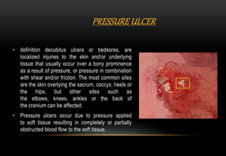 • definition decubitus ulcers or bedsores, are
localized injuries to the skin and/or underlying
tissue that usually occur over a bony prominence
as a result of pressure, or pressure in combination
with shear and/or friction. The most common sites
are the skin overlying the sacrum, coccyx, heels or
the hips, but other sites such as
the elbows, knees, ankles or the back of
the cranium can be affected.
• Pressure ulcers occur due to pressure applied
to soft tissue resulting in completely or partially
obstructed blood flow to the soft tissue.
PRESSURE ULCER
 