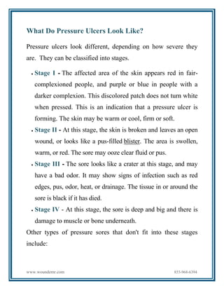 www.woundemr.com 855-968-6394
What Do Pressure Ulcers Look Like?
Pressure ulcers look different, depending on how severe they
are. They can be classified into stages.
 Stage I - The affected area of the skin appears red in fair-
complexioned people, and purple or blue in people with a
darker complexion. This discolored patch does not turn white
when pressed. This is an indication that a pressure ulcer is
forming. The skin may be warm or cool, firm or soft.
 Stage II - At this stage, the skin is broken and leaves an open
wound, or looks like a pus-filled blister. The area is swollen,
warm, or red. The sore may ooze clear fluid or pus.
 Stage III - The sore looks like a crater at this stage, and may
have a bad odor. It may show signs of infection such as red
edges, pus, odor, heat, or drainage. The tissue in or around the
sore is black if it has died.
 Stage IV - At this stage, the sore is deep and big and there is
damage to muscle or bone underneath.
Other types of pressure sores that don't fit into these stages
include:
 