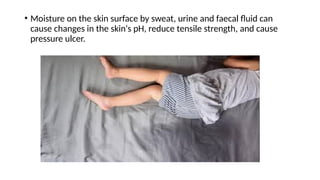• Moisture on the skin surface by sweat, urine and faecal fluid can
cause changes in the skin‘s pH, reduce tensile strength, and cause
pressure ulcer.
 