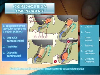 CRIPTORQUIDIA
           FISIOPATOGENIA



El descenso normal                                                  1. G.Testis.
testicular comprende
3 etapas (Kogan):                                                   2. Pene.

1. Migración                                                        3. Canal
   transabdominal                                                      Inguinal.

                                                                    4. Testículo.
2. Pasividad
                                                                    5. Cavidad
3. Migración                                                           Peritoneal.
   transinguinal
                                                                    6. Conducto
                                                                       Deferente.


      Cualquier anomalía a cualquier potencialmente causa criptorquidia
 