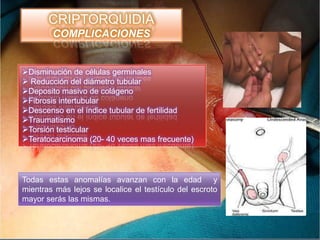 CRIPTORQUIDIA
        COMPLICACIONES


Disminución de células germinales
 Reducción del diámetro tubular
Deposito masivo de colágeno
Fibrosis intertubular
Descenso en el índice tubular de fertilidad
Traumatismo
Torsión testicular
Teratocarcinoma (20- 40 veces mas frecuente)




Todas estas anomalías avanzan con la edad y
mientras más lejos se localice el testículo del escroto
mayor serás las mismas.
 