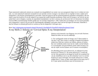 Naast anatomisch onderzoek omtrent een eventuele (on-)mogelijkheid van ruimte voor een anorganisch object om in te dalen tot in de
nek, is er ook anatomisch materiaal verzameld om een normale correcte weergave van nekwervels in vergelijk te tonen, omdat op de
röntgenfoto’s ook hiermee gemanipuleerd is geworden. Naast het gegeven dat het technisch/praktisch gesproken onmogelijk is dat een
object vanuit het hoofd tot in de nek indaalt in een maand tijd zonder bemerkte problemen, bleek ook de weergave van wervels op een
aantal foto’s niet te kloppen, waarmee de onjuistheid (manipulatie) van foto’s sowieso als een bewezen feit is te benoemen, bovendien
toont de MRI overeenkomstige beelden gelijke die van normale röntgenfoto’s. (NB: Tijdens het vervaardigen van een recent gemaakte
serie röntgenfoto’s moest ik op een aan de wand hangende uitklapbare stoel gaan zitten met het lijf tegen de fotowand. Zodoende is
dan het lichaam in stilstand gefixeerd en voorkom je dat de röntgenfoto’s bewogen zijn.)
Bron: http://calsprogram.org/manual/volume2/Section10_XraySkills/03-XraySk2CerSpineXrayInterp13.html
X-ray Skills 2: Selectie uit ‘Cervical Spine X-ray Interpretation’
Selectie uit de instructie voor diagnose van cervicale fracturen.
Maakt het tellen van wervels makkelijk.
(1. De voorliggende ruimte ter hoogte van C3 dient minder te
zijn dan 5 mm. Deze ruimte is moeilijk te bepalen bij kinderen
omdat deze flink kan variëren met slikken, ademen en huilen.
De voor-vertebrale ruimte moet niet de wijdte van het lichaam
C2 overschrijden. De prevertebrale ruimte onder de larnys sou
niet de wijdte van het lichaam van C6 moeten overschrijden.)
De afbeelding toont zeven nekwervels, en onderaan de eerste
borstwervel (Thorax) T1. De eerste nekwervel C1 wordt ook
wel de Atlas genoemd en de draagt het hoofd, het occipitaal bot
van de schedelbasis rust er op. Het uitsteeksel van C1 is om het
hoofd op en neer te bewegen. De tweede nekwervel C2 steekt
midden door C1 heen, en daar vanuit lopen uit het merg van C2
de 32 paar spinal-zenuwbanen naar de hersenstam toe.
10
 