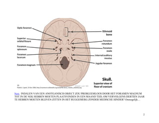 Next INDALEN VAN EEN ANOTGANISCH OBJECT ZOU PROBLEEMLOOS DOOR HET FORAMEN MAGNUM
TOT IN DE NEK HEBBEN MOETEN PLAATSVINDEN IN EEN MAAND TIJD, OM VERVOLGENS DERTIEN JAAR
TE HEBBEN MOETEN BLIJVEN ZITTEN IN HET RUGGEMERG ZONDER MEDISCHE HINDER? Onmogelijk…
2
 