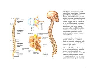 In the Spinaal Kanaal (Spinal Cord)
lopen 32 paar zenuwbanen. Tussen het
Spinaal Kanaal en de Processus
Spinoza (Spinous Processus) zou een
metalen object van enige centimeters in
gedaald hebben en klem hebben komen
te zitten tussen C2 en C3. Ik merk op
dat het hoofd beweegbaar is; als daar
een object van enige centimeters daar
aanwezig was, dan zou er met het
bewegen van het hoofd frictie hebben
ontstaan, en daarmee druk op de
zenuwen. Dit zou dan een schade-
berokkenend effect te weeg moeten
hebben gebracht.
Bovendien als daar een object was
gelegen, dan had het C3 niet naar
binnen toe omkneld, zoals we op MRI
kunnen zien, maar dan had het C3 naar
buiten toe open gedrukt.
Ook deze afbeelding maakt duidelijk
dat het erg onwaarschijnlijk is dat een
metalen object ingedaald is van
binnenin in het hoofd tot in de nek. (De
afbeelding is afkomstig van internet;
we zijn allen dankbaar voor het online
delen van informatie op the internet.)
9
 