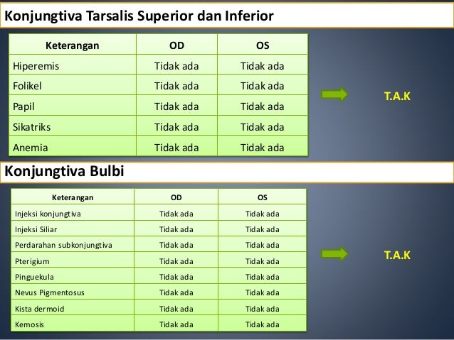 Katarak Imatur