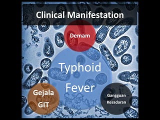 Typhoid
Fever
Demam
Gangguan
Kesadaran
Gejala
GIT
Clinical Manifestation
 