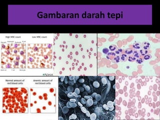Gambaran darah tepi
 