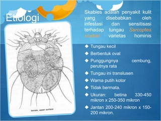 Skabies adalah penyakit kulit
yang disebabkan oleh
infestasi dan sensitisasi
terhadap tungau Sarcoptes
scabiei varietas hominis
 Tungau kecil
 Berbentuk oval
 Punggungnya cembung,
perutnya rata
 Tungau ini translusen
 Warna putih kotor
 Tidak bermata.
 Ukuran: betina 330-450
mikron x 250-350 mikron
 Jantan 200-240 mikron x 150-
200 mikron.
Etiologi
 