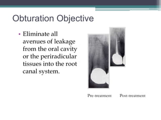 Obturation Objective
 • Eliminate all
   avenues of leakage
   from the oral cavity
   or the periradicular
   tissues into the root
   canal system.


                           Pre-treatment   Post-treatment
 