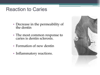 Reaction to Caries

   • Decrease in the permeability of
     the dentin

   • The most common response to
     caries is dentin sclerosis.

   • Formation of new dentin

   • Inflammatory reactions.
 