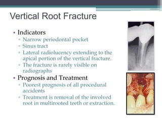 Vertical Root Fracture
• Indicators
  ▫ Narrow periodontal pocket
  ▫ Sinus tract
  ▫ Lateral radiolucency extending to the
    apical portion of the vertical fracture.
  ▫ The fracture is rarely visible on
    radiographs
• Prognosis and Treatment
  ▫ Poorest prognosis of all procedural
    accidents
  ▫ Treatment is removal of the involved
    root in multirooted teeth or extraction.
 