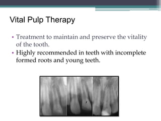 Vital Pulp Therapy

• Treatment to maintain and preserve the vitality
  of the tooth.
• Highly recommended in teeth with incomplete
  formed roots and young teeth.
 
