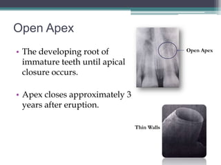 Open Apex
• The developing root of                     Open Apex

  immature teeth until apical
  closure occurs.

• Apex closes approximately 3
  years after eruption.

                                Thin Walls
 
