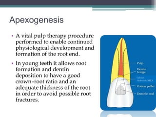 Apexogenesis
• A vital pulp therapy procedure
  performed to enable continued
  physiological development and
  formation of the root end.
• In young teeth it allows root
  formation and dentin
  deposition to have a good         Calcium

  crown–root ratio and an           Hydroxide/MTA


  adequate thickness of the root
  in order to avoid possible root
  fractures.
 