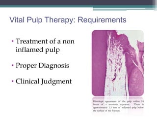 Vital Pulp Therapy: Requirements

• Treatment of a non
  inflamed pulp

• Proper Diagnosis

• Clinical Judgment

                       Histologic appearance of the pulp within 24
                       hours of a traumatic exposure.     There is
                       approximately 1.5 mm of inflamed pulp below
                       the surface of the fracture.
 